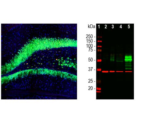 Mouse Anti-Cellular Oncogene FOS (c-FOS)