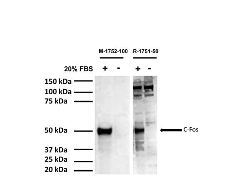 Mouse Anti-Cellular Oncogene FOS (c-FOS)