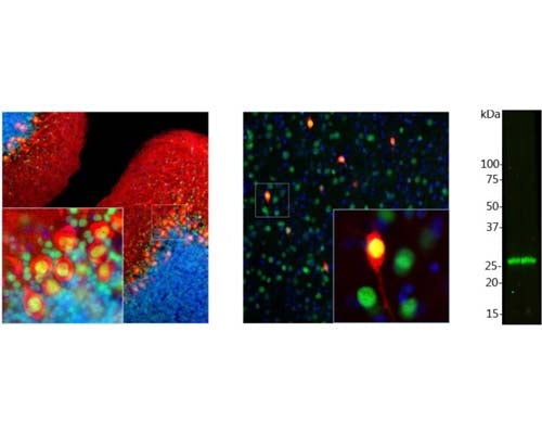 Mouse Anti-Calbindin-Binding Protein