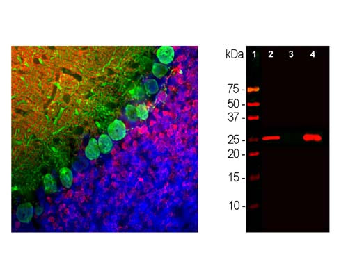 Mouse Anti-Calbindin-Binding Protein