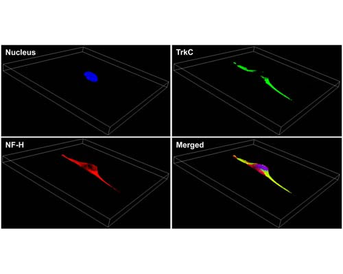 Mouse Anti-Tyrosine Kinase Receptor C (TrkC)