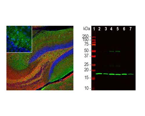 Mouse Anti-Beta-Synuclein