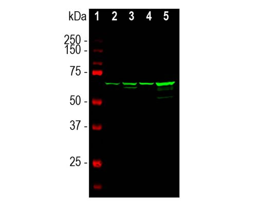 Mouse Anti-Neurofilament Light Polypeptide (NF-L, 7D1)