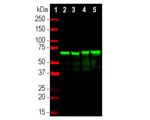 Mouse Anti-Neurofilament Light Polypeptide (NF-L, 6H112)