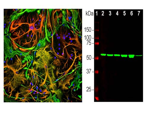 Mouse Anti-Vimentin (Clone 2A52)