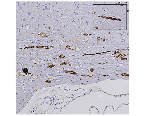 Mouse Anti-Neurofilament Light Polypeptide (NF-L), DG-Sensor (1D44)