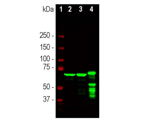 Mouse Anti-Neurofilament Light Polypeptide (NF-L, 1B11)