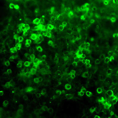 Neurosphere (organoid) cultures of e13 mouse brain were cultured for 2 weeks, and then paraformaldehyde (2%) fixed. After extensive washing, the cultures were incubated with Netrin-1 antibody (1:500 dilution), washed, and then treated with fluorescein-labeled goat anti-chicken IgY (1:500 dilution).