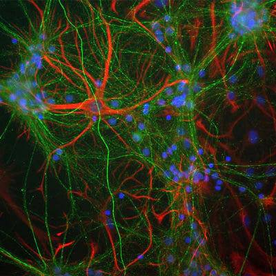 Immunocytochemical staining of NF-M immunoreactivity (green) and Glial Fibrillary Acidic Protein (GFAP, red) in a culture of mouse cortical neurons. The chicken anti-NFM immunostaining was performed using a 1:2000 dilution, and the GFAP immunostaining was performed using a 1:5000 dilution. Photomicrographs from Dr.