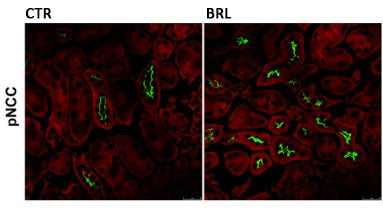 Immunostaining of mouse kidney sections from control (CTL) and BRL37344 treated (BRL, 1 mg/kg) specifically labeling localized phosphorylated NCC thr53 (green) and counterstained with Evans Blue (in red). Image from publication. CC-BY-4.0, PMID: 38652212
