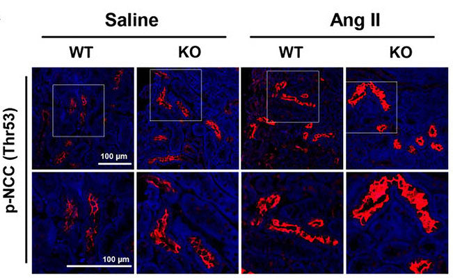 Immunolabeling of mouse kidney paraffin section specifically detecting NCC Thr53 (red, 1:1000) phosphorylation with the increased NCC activation in Ang-II-infused Prdx5 KO kidney. Image from publication, CC-BY-4.0. PMID: 39857434.