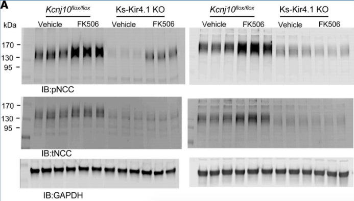 Two Western blots show the abundance of pNCCT53 (1:200) and tNCC in male Kcnj10fl/fl mice and in Ks-Kir4.1–KO mice treated with vehicle (control) and FK506 (0.75 mg/kg BW). Image from publication CC-BY-4.0. PMID: 36821372