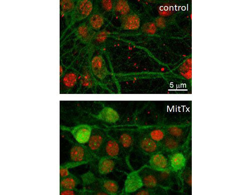 Immunolabeling of cultured mouse hippocampal neurons fixed and stained with anti-phospho-ERK/MAPK Thr202/Tyr204 (green, 1:100) and red nuclear stain Propidium Iodide. The labeling identifies an increase in ERK/MAPK phosphorylation when hippocampal neurons are treated with a specific ASIC1a activator, MitTx toxin (20 nM, 4 min). Image kindly provided by Carina Weissmann, IFIBYNE-CONICET.