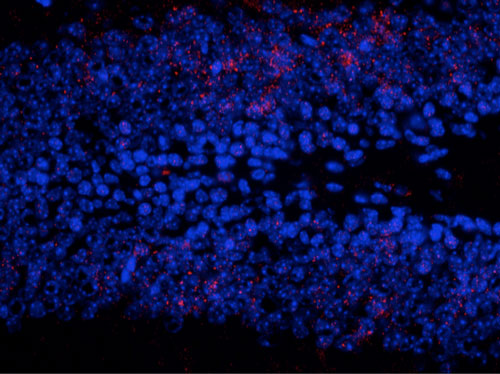 Immunostaining of granule cells in the dentate gyrus of the hippocampus from saline treated mouse brain staining ERK/MAPK when phosphorylated at Thr202/Tyr204 1:500, red). The blue is staining nuclei with DAPI. The MAPK positive neurons show punctate staining primarily localized in the nucleus with few staining both cytoplasmic and nuclear. Photo courtesy of Robert Wine.