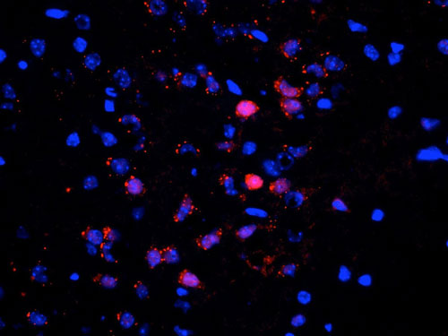 Immunostaining of neurons in the frontal cortex of saline treated mouse brain identifying cytoplasmic and nuclear staining of ERK/MAPK when phosphorylated at Thr202/Tyr204 red, 1:500). The intense nuclear staining of a few neurons shows stimulation of the neuron resulting in translocation of the protein. The blue is staining nuclei with DAPI. Photo courtesy of Robert Wine.