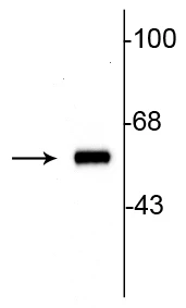 Rabbit Anti-Tyrosine Hydroxylase