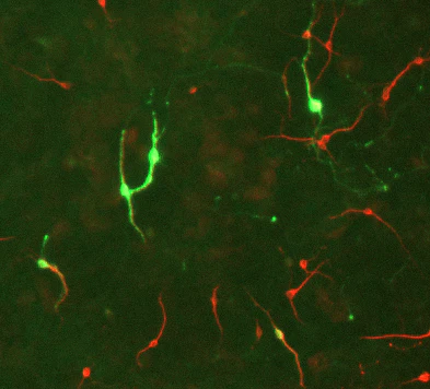 Rabbit Anti-Tyrosine Hydroxylase