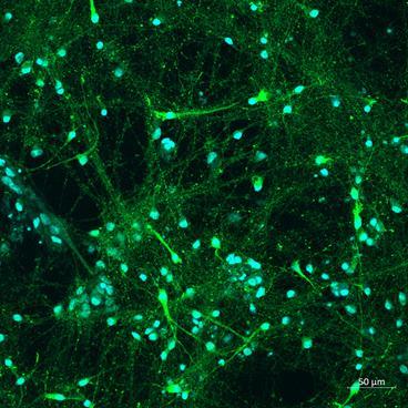 Rabbit Anti-Tyrosine Hydroxylase
