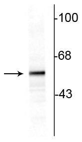 Sheep Anti-Tyrosine Hydroxylase