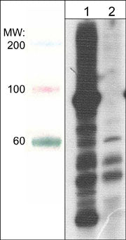 Western blot analysis of A431 cells treated with calyculin A (100 nM) for 30 min (lane 1) then treated with lambda phosphatase (lane 2). The blot was probed with anti-Phosphoserine/threonine rabbit polyclonal at 1:1000.