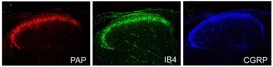 Adult mouse spinal cord was fixed in 4% paraformaldehyde, paraffin-embedded and sectioned, and then sections were stained for PAP immunoreactivity (1:500 dilution). Adjacent sections were co-stained for IB4 and Calcitonin Gene-Related Protein (CGRP) (other sensory neuronal markers). Photomicrograph by Dr. Mark Zilka, University of North Carolina.