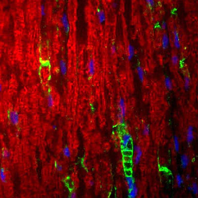 In the image (a tissue section through an adult sciatic nerve), Po (green staining) can be seen in the myelin and Schwann cell processes surrounding the nodes of Ranvier. In this photomicrograph, rabbit antibodies against LAMP (lysozome-associated membrane glycoprotein) (red staining) serves as the counterstain, and DAPI (blue staining) allows visualization of nuclei.
