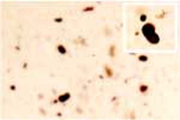 Rabbit Anti-Alpha-Synuclein