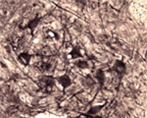 Rabbit Anti-NGFR/p75 Neurotrophin Receptor (p75NTR)