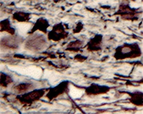 Rabbit Anti-NGFR/p75 Neurotrophin Receptor (p75NTR)