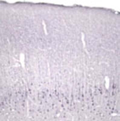 Rabbit Anti-Neurotrophin-4/5 (NT-4/5)