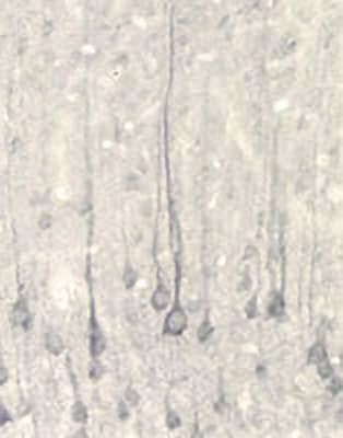 Rabbit Anti-Neurotrophin-4/5 (NT-4/5)