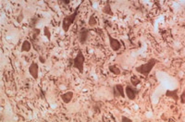 Rabbit Anti-Parkinson Disease Protein 2 (Parkin)
