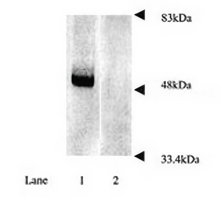 Rabbit Anti-Parkinson Disease Protein 2 (Parkin)