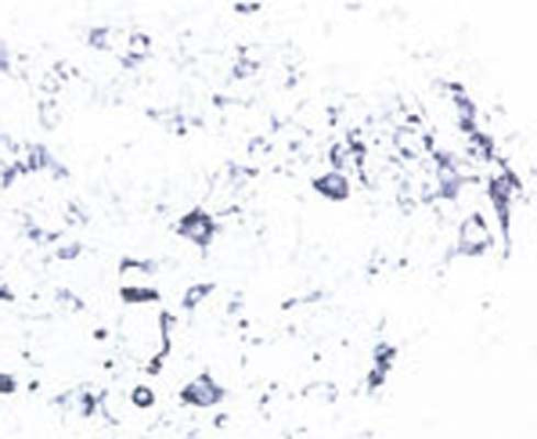 Rabbit Anti-Tyrosine Kinase Receptor B (TrkB)