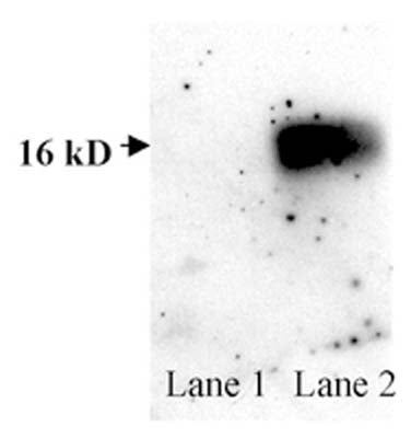Rabbit Anti-Superoxide Dismutase 1 (SOD1)