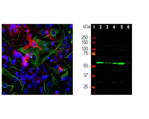 Rabbit Anti-Coronin 1a