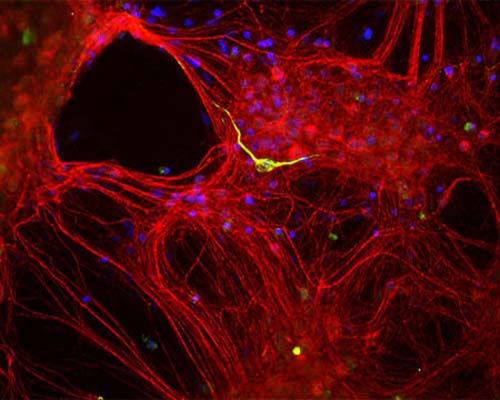 Rabbit Anti-Internexin Alpha (Alpha-Inx)
