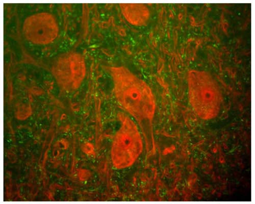 Rabbit Anti-Neurofilament Heavy Polypeptide, Phosphorylated, (pNF-H)