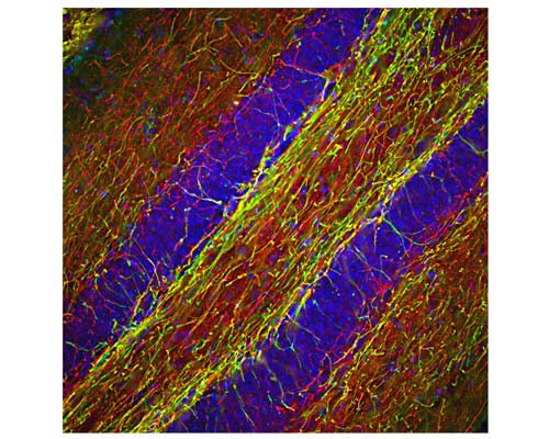 Rabbit Anti-Neurofilament Heavy Polypeptide, Phosphorylated, (pNF-H)