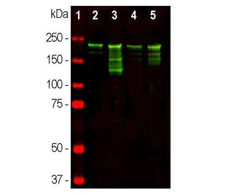 Rabbit Anti-Neurofilament Heavy Polypeptide, Phosphorylated, (pNF-H)