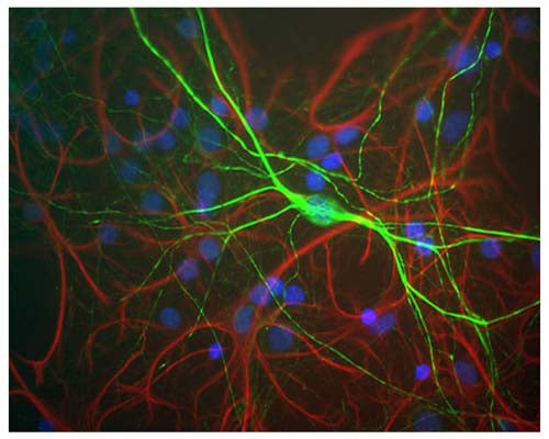 Rabbit Anti-Neurofilament Heavy, Phosphorylated and Non-Phosphorylated (pNF-H)
