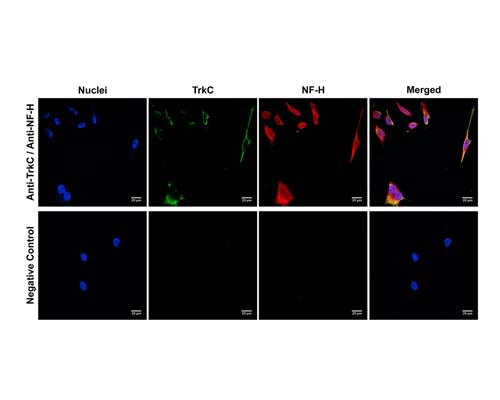 Rabbit Anti-Neurofilament Heavy, Phosphorylated and Non-Phosphorylated (pNF-H)