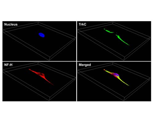 Rabbit Anti-Neurofilament Heavy, Phosphorylated and Non-Phosphorylated (pNF-H)