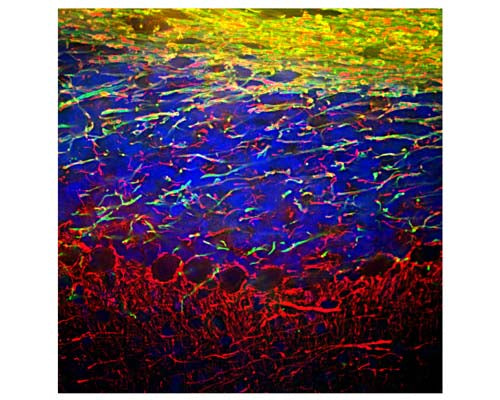 Rabbit Anti-Neurofilament Light Polypeptide (NF-L)