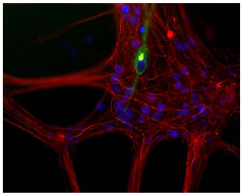 Rabbit Anti-Neurofilament Light Polypeptide (NF-L)