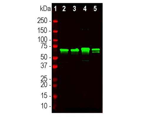 Rabbit Anti-Neurofilament Light Polypeptide (NF-L)