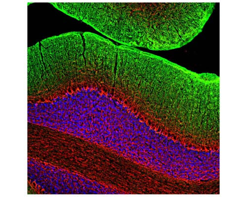 Rabbit Anti-Neurofilament Medium Polypeptide (NF-M)