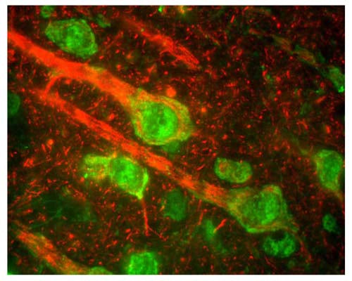 Rabbit Anti-Neurofilament Medium Polypeptide (NF-M)