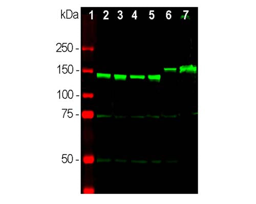 Rabbit Anti-Neurofilament Medium Polypeptide (NF-M)