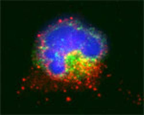 Rabbit Anti-Microtubule-Associated Proteins 1A/1B Light Chain 3A (MAP1LC3A)